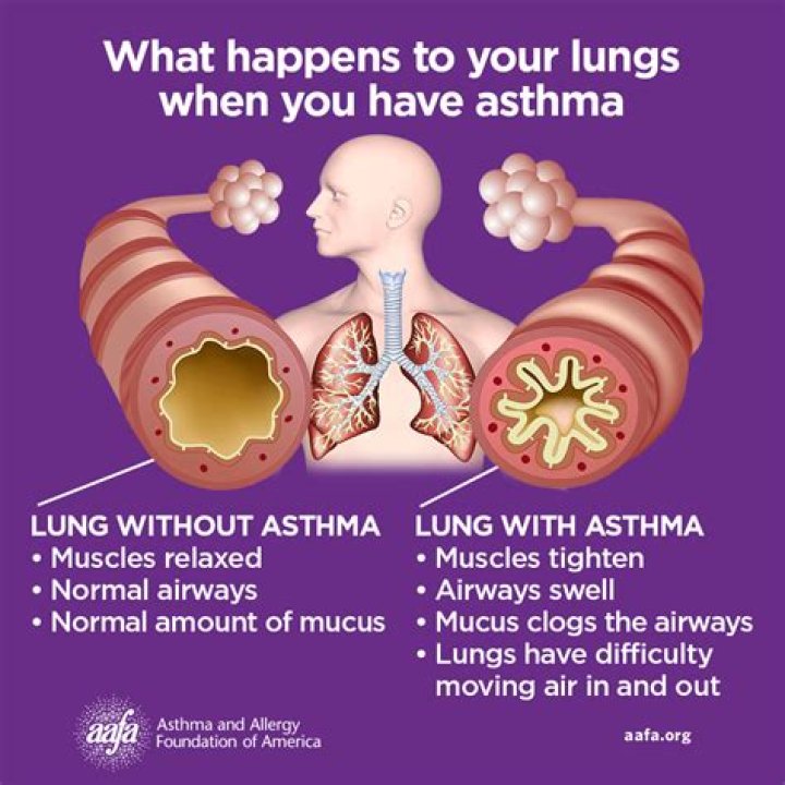 What blood type has asthma?