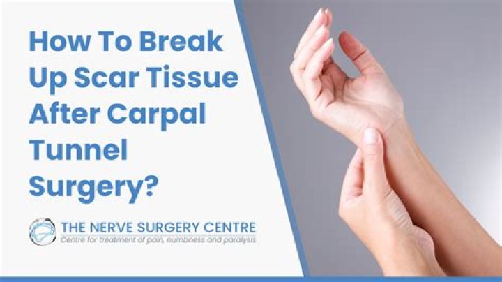 What can you do 2 weeks after carpal tunnel surgery?