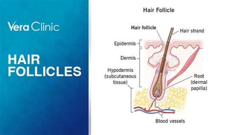 What causes dead hair follicles?