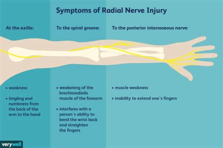 What causes nerve damage?