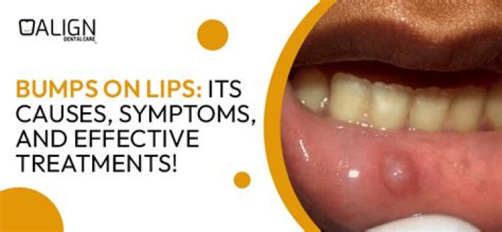 What causes permanent limps?