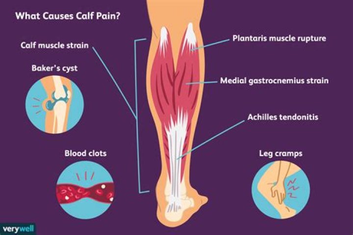 What causes severe muscle pain in both legs and arms?