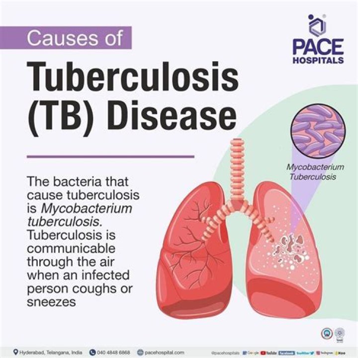 What causes TB?