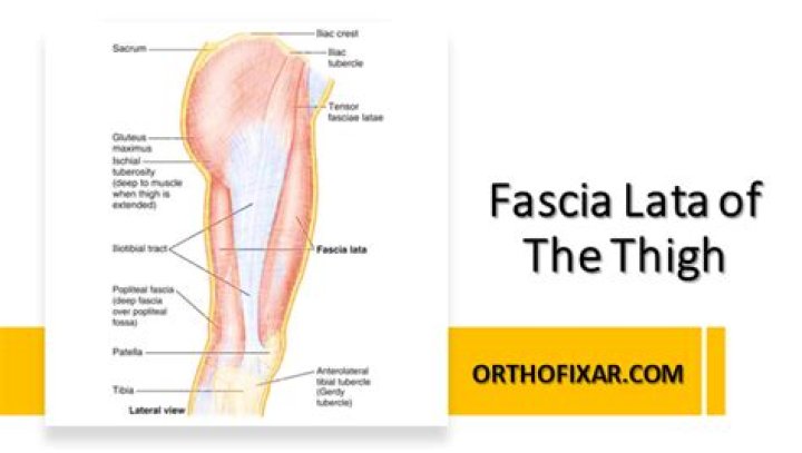What causes tight fascia?