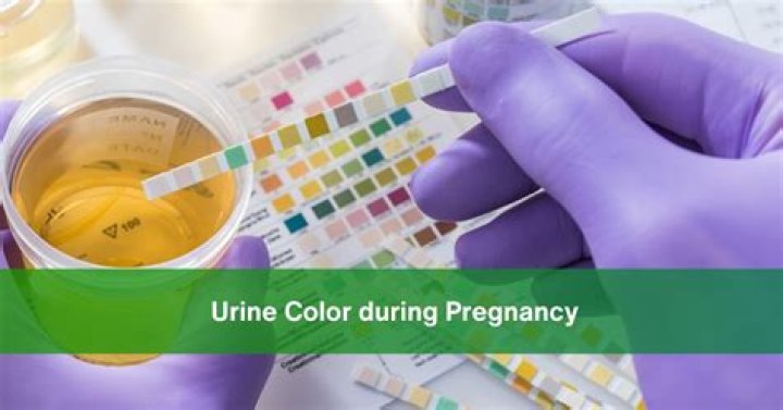 What color is your urine when you are pregnant?