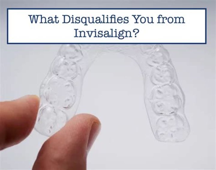 What disqualifies you from getting Invisalign?