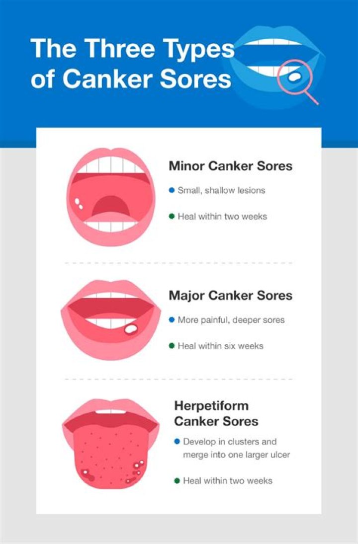 What do canker sores look like?