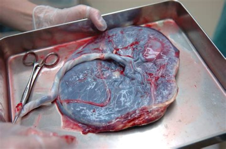 What do doctors do with your placenta?