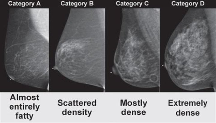 What do large breasts indicate?