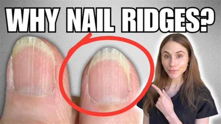 What do nail ridges mean?