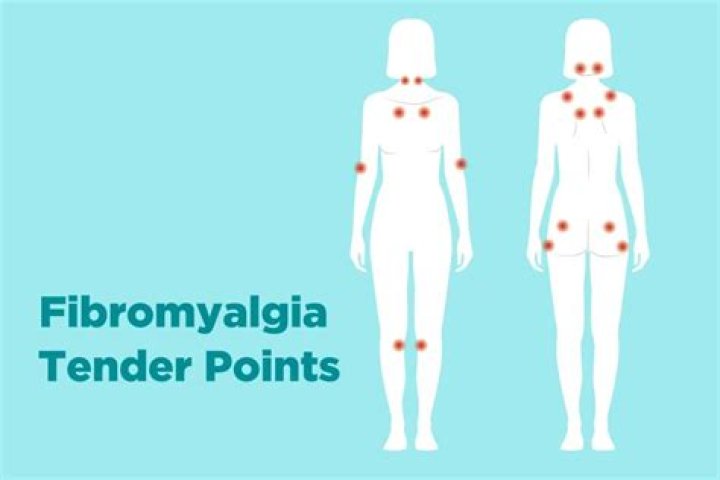What doctor can diagnose fibromyalgia?