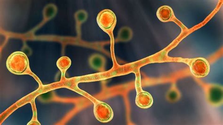 What does body fungus smell like?