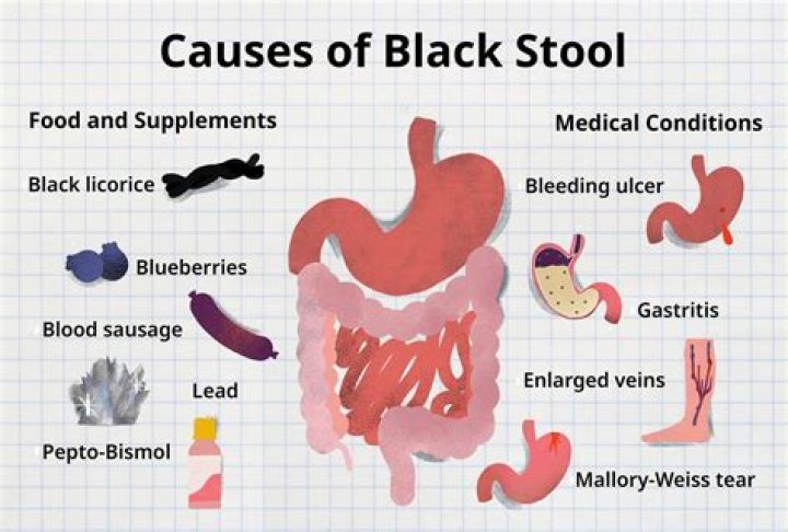 What does cirrhosis poop look like?