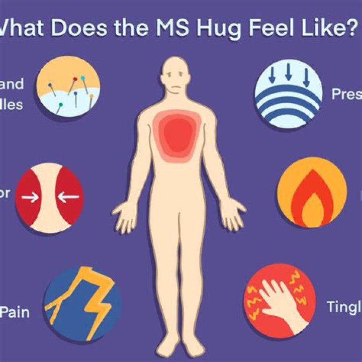 What does MS feel like in arms?