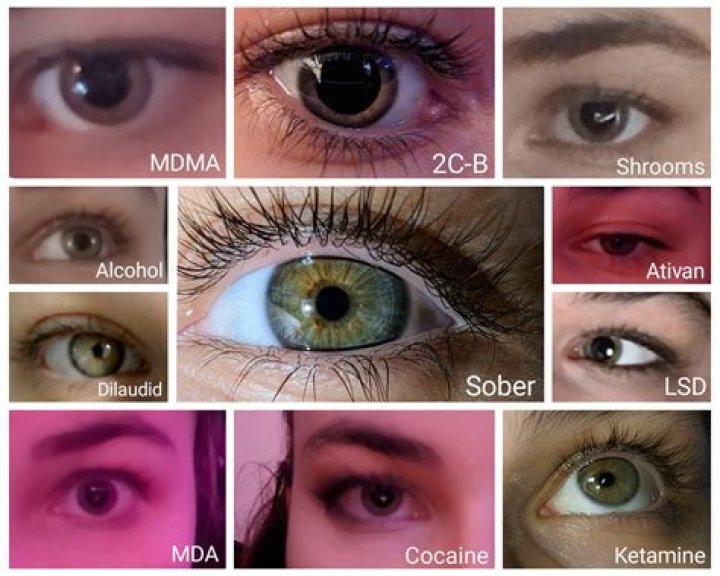 What drugs can change eye color?