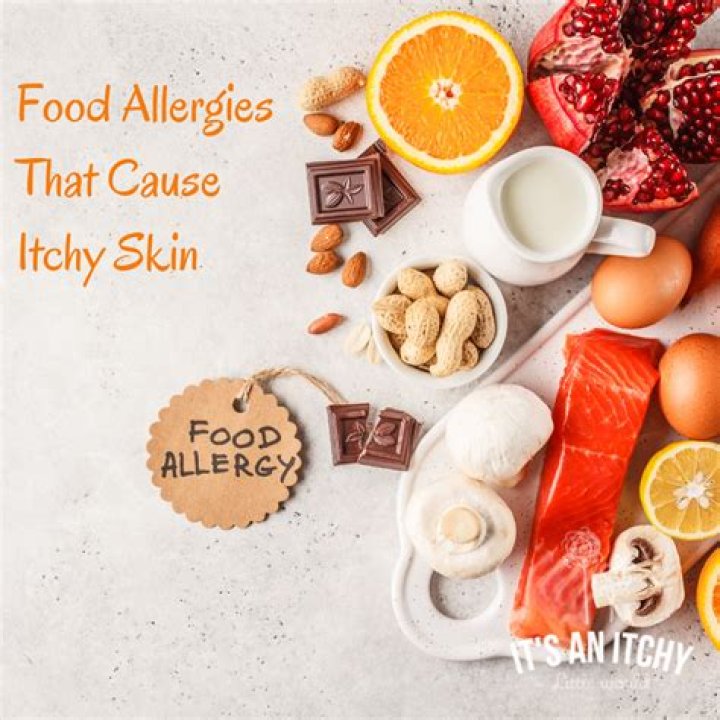 What foods cause itchy skin?