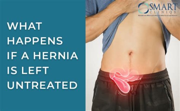 What happens if a hernia in stomach is left untreated?