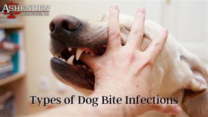What happens if vaccinated dog bites?