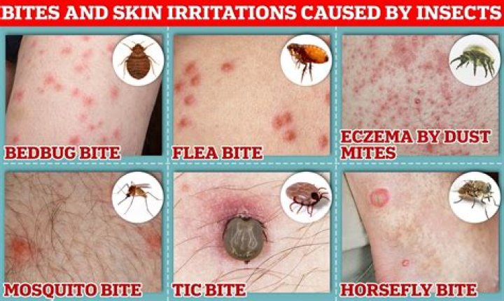 What happens if you don't get rid of bed bugs?