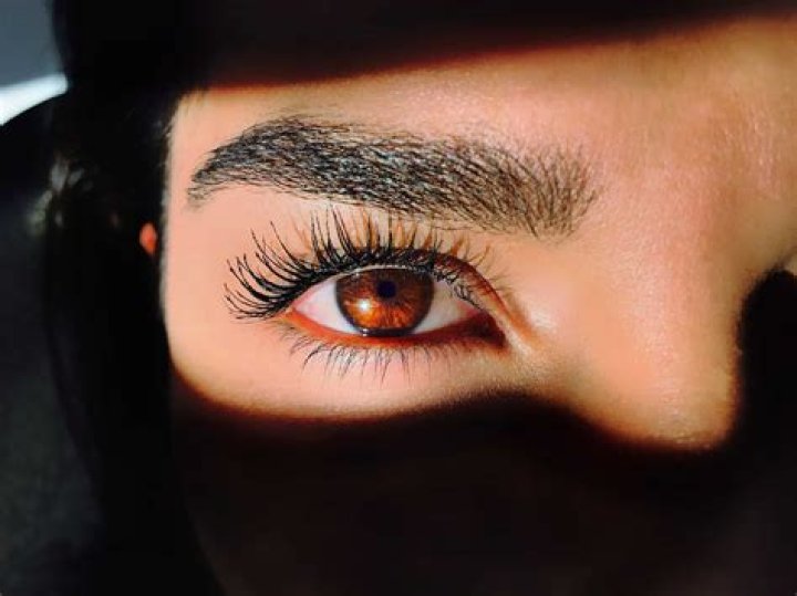 What is a Fox eyebrow?