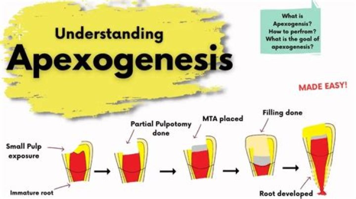 What is Apexogenesis and Apexification?