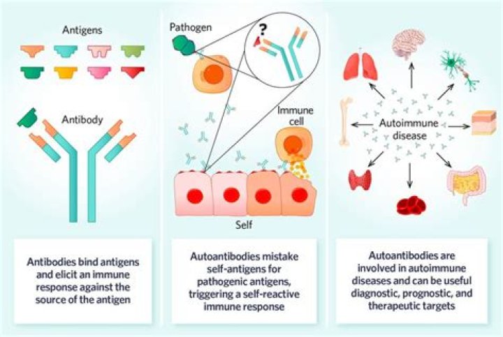 What is autoimmune gastrointestinal dysmotility?