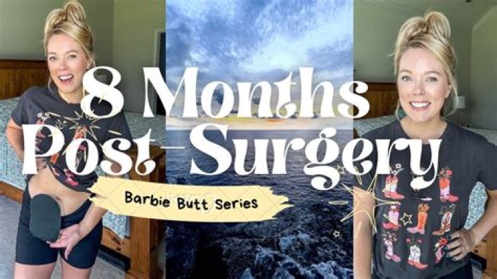 What is Barbie bum surgery?
