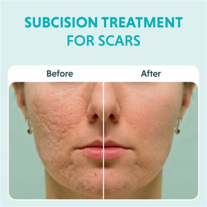 What is best for scars?