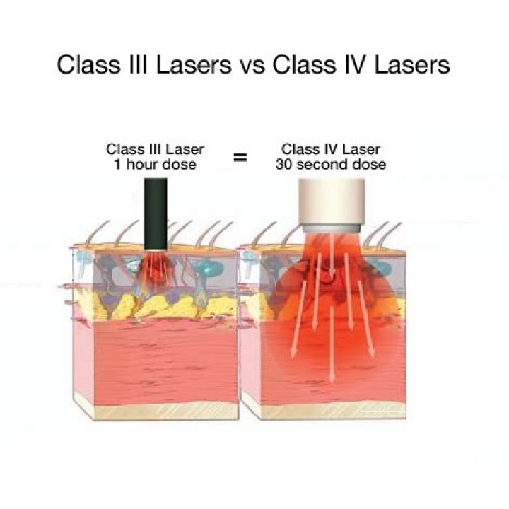 What is class 3 laser?