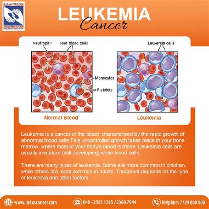 What is end stage leukemia?