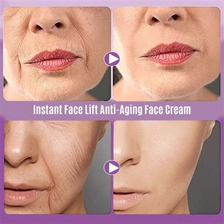 What is instant face lift?