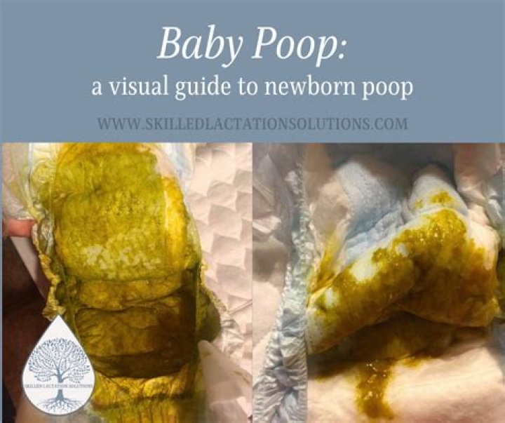 What is it called when baby poops in womb?