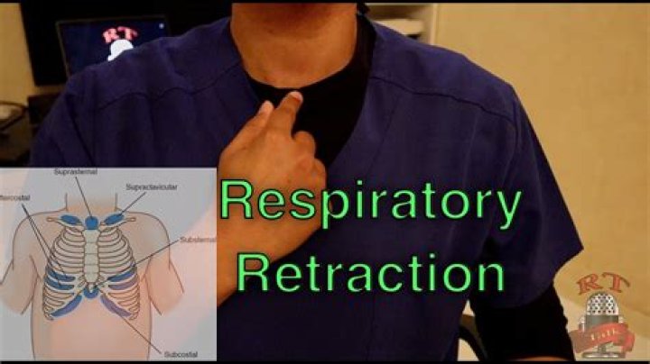 What is retraction breathing?