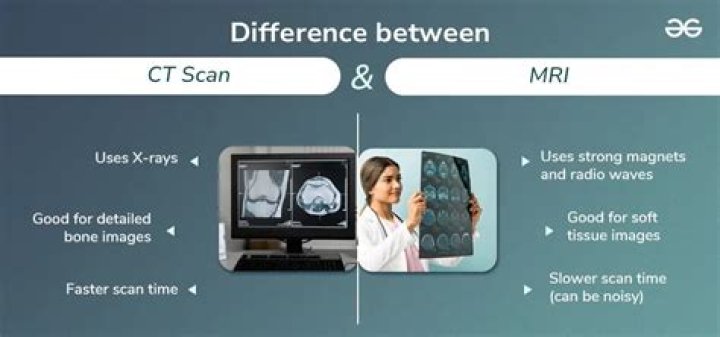 What is the difference between SCAN Classic and SCAN prime?