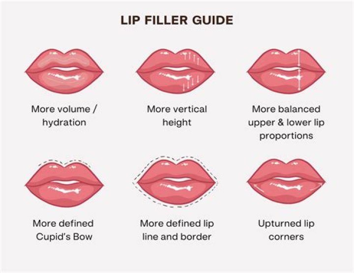What is the least amount of lip filler you can get?