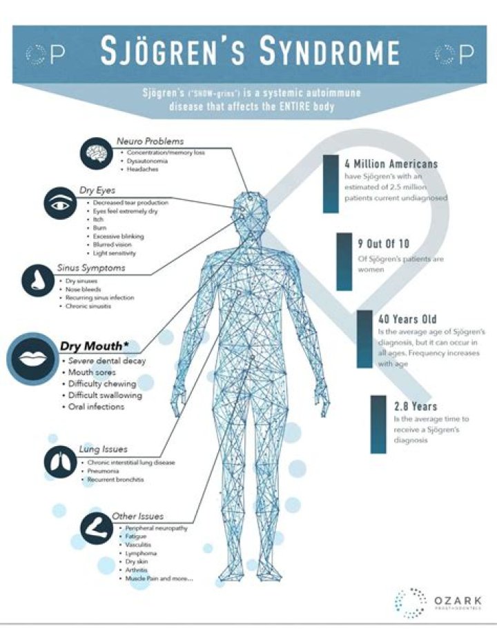 What is the life expectancy of Sjogren's syndrome?