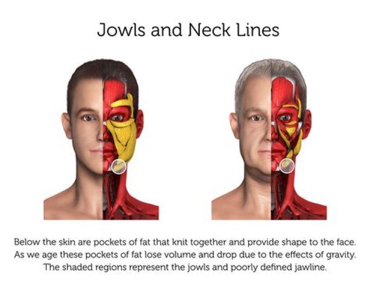 What is the meaning of jowly?