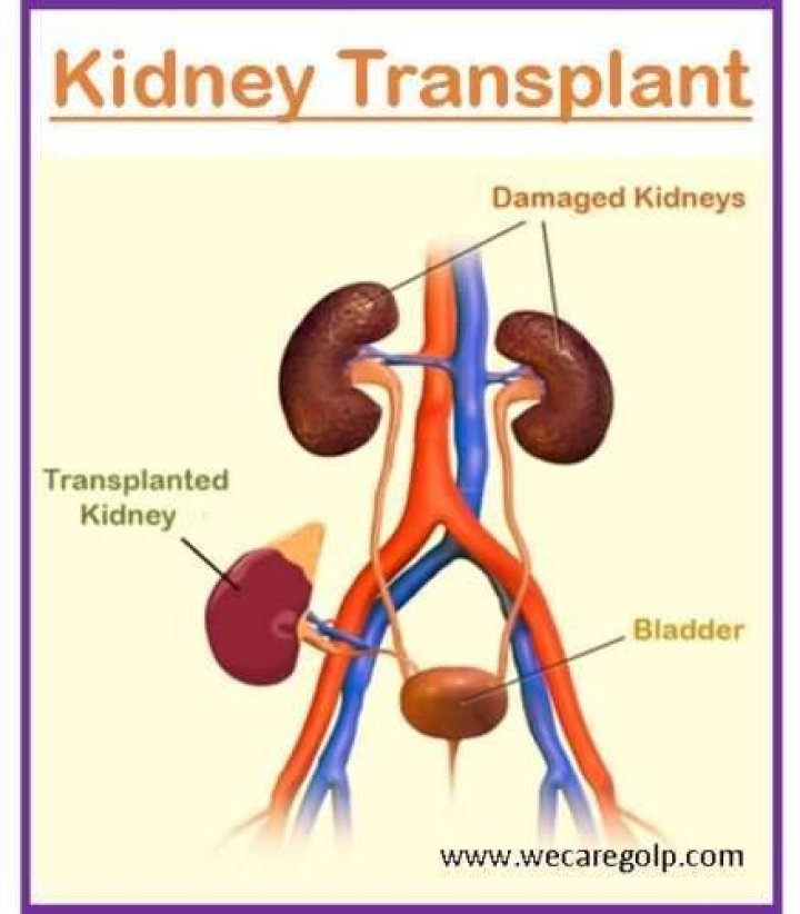 What is the oldest age for kidney transplant?
