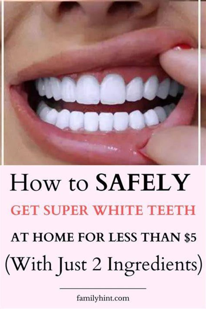 What is the safest way to whiten teeth at-home?