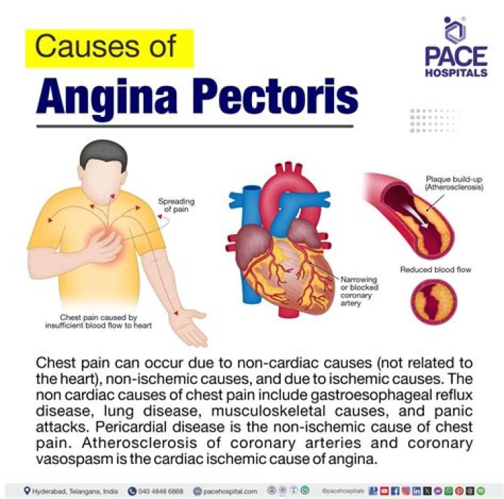 What is throat angina?
