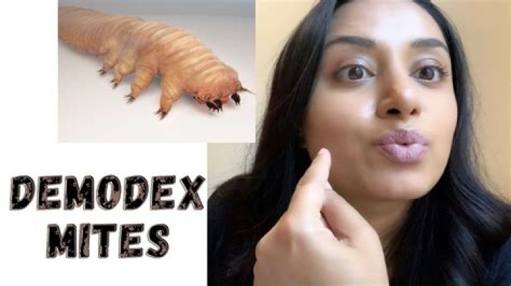 What kills Demodex mites on face?