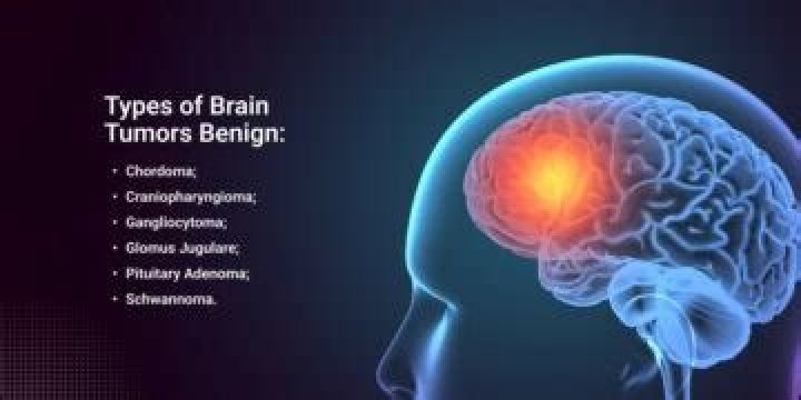 What makes a tumor benign?