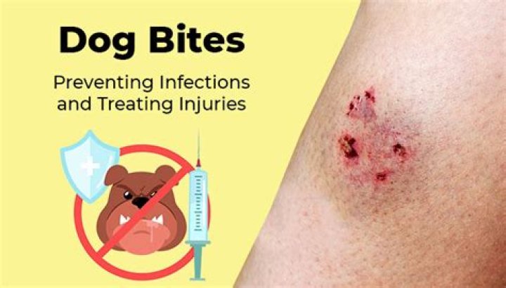 What percent of dog bites get infected?