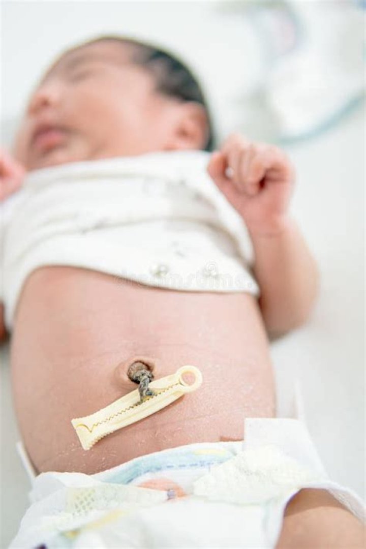What should a newborn's belly button look like after the cord falls off?
