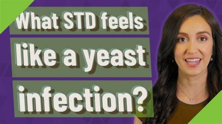 What STD feels like a yeast infection?
