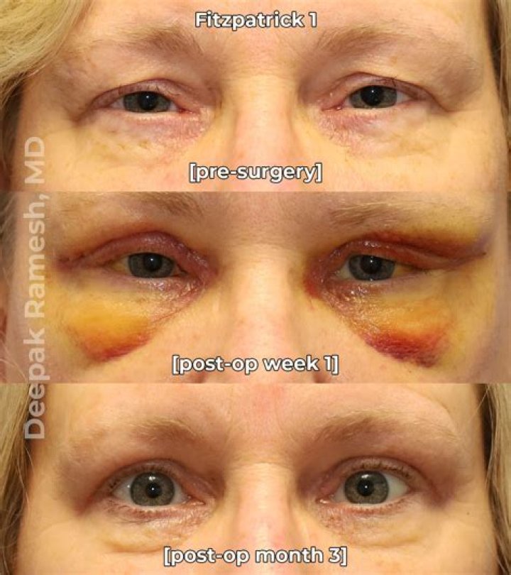What surgery has the shortest recovery time?