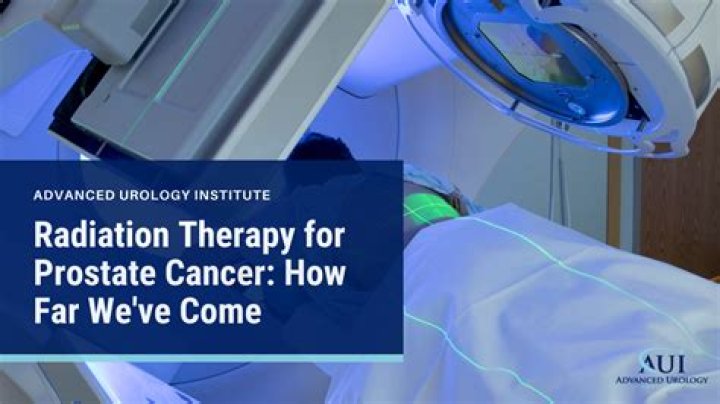 What time of day is best for radiation therapy?