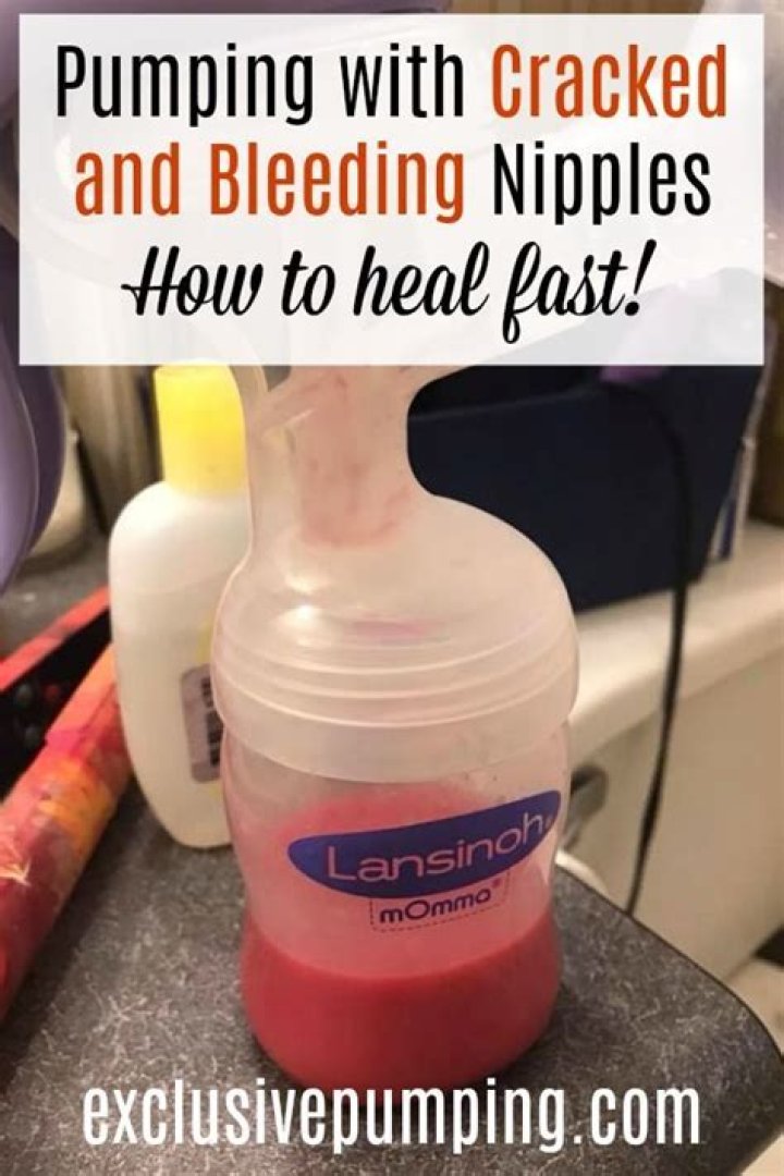 What to do with cracked nipples when pumping?