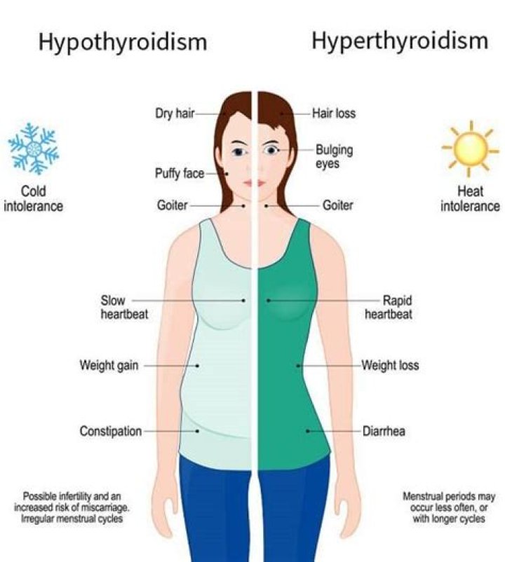 What TSH level is considered hypothyroidism?