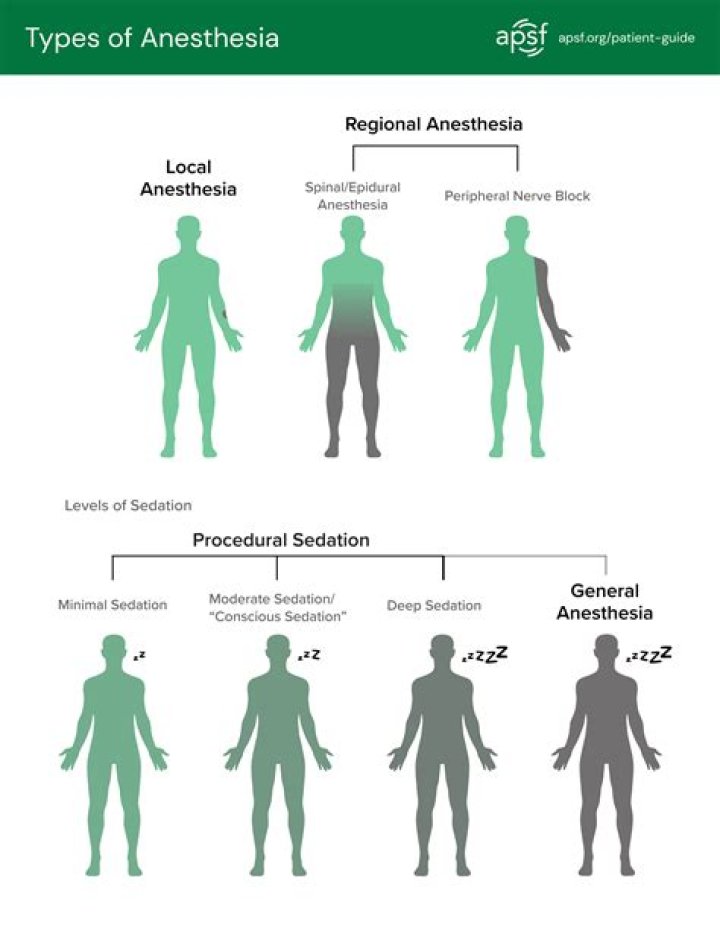 What type of anesthesia is used for vitrectomy?